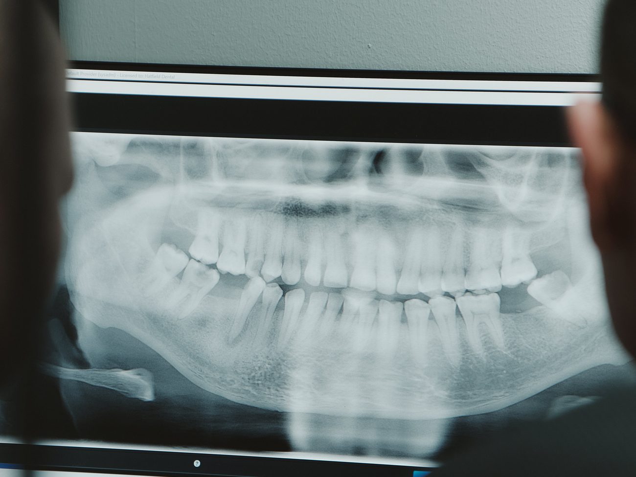 Digital dental imaging technology at Hatfield Dental Studio